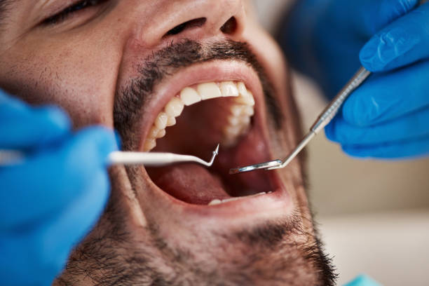 Best Walk-In Emergency Dentist in Bell, CA